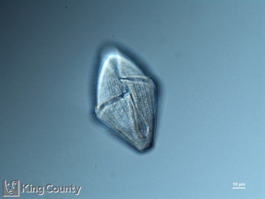 Photo of Gymnodinium gracile